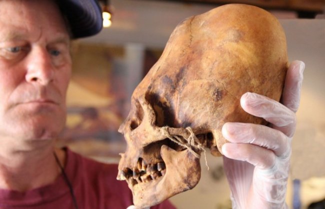 Красота требует жертв: 10 исторических примеров деформации черепов древними ...
