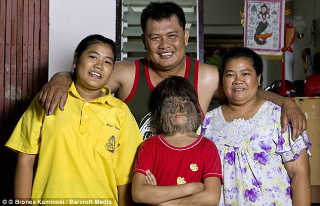 Самая волосатая девушка в мире из Таиланда побрилась и вышла замуж