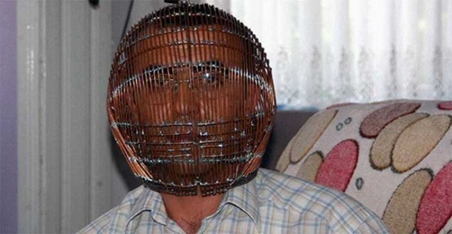 Житель Турции закрыл голову в клетке, чтобы избавиться от никотиновой завис ...