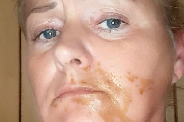 Женщину госпитализировали после того, как собака случайно наложило ей на лицо и в рот, когда та спала