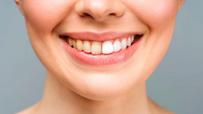 Почему темнеют зубы
